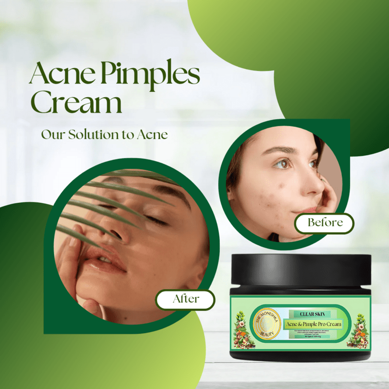 acne cream 20260114 174839 0000.png